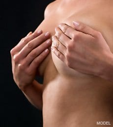 Revision Breast Augmentation model